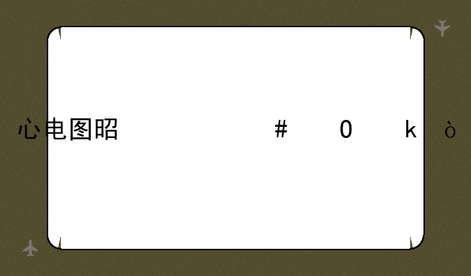心电图是什么专业？